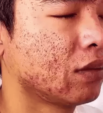 Mascarilla de té verde para limpieza Facial